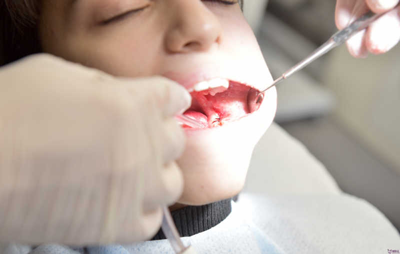 Dentist Near me in Madurai