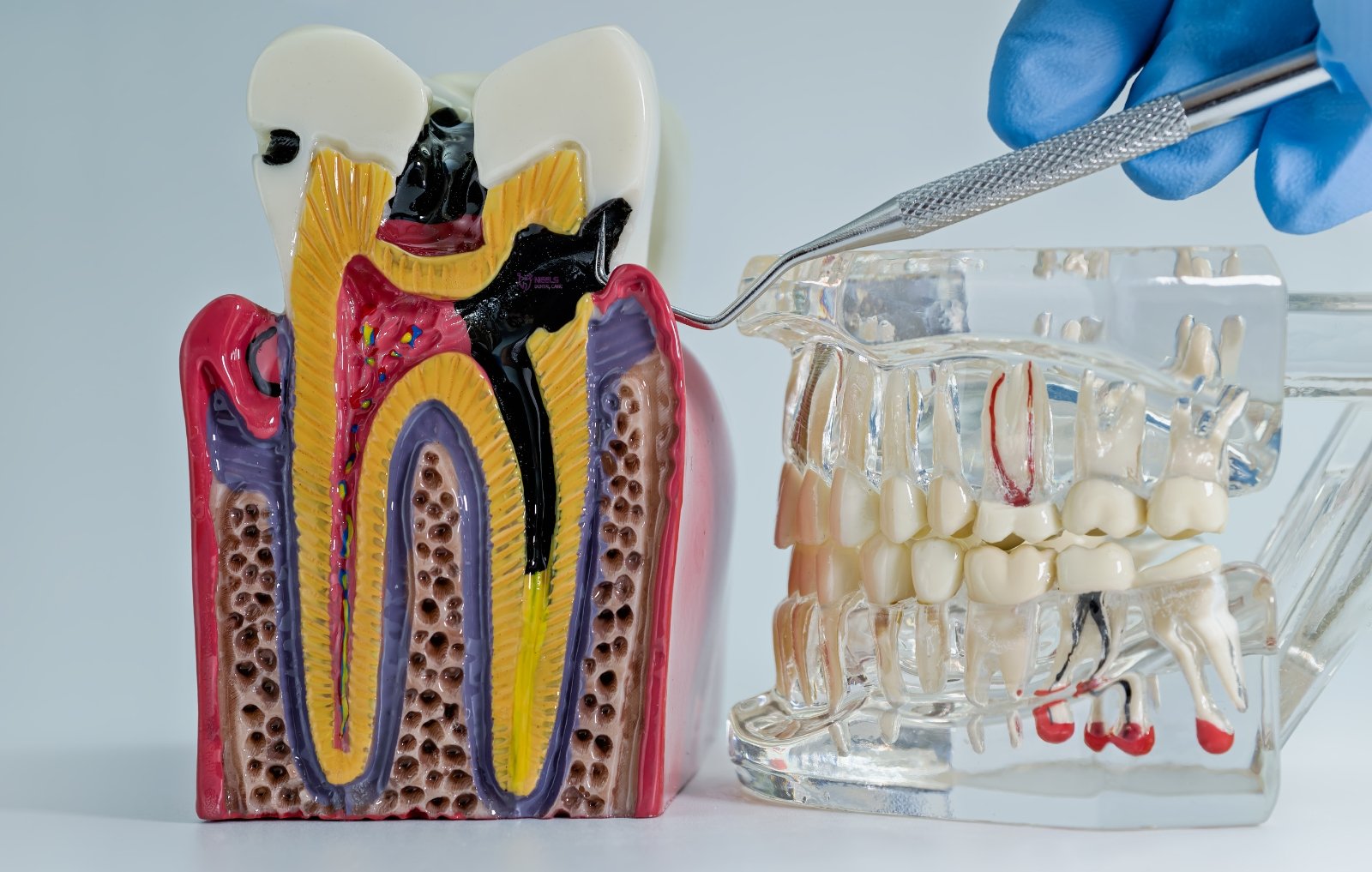 Dental Clinic in Madurai