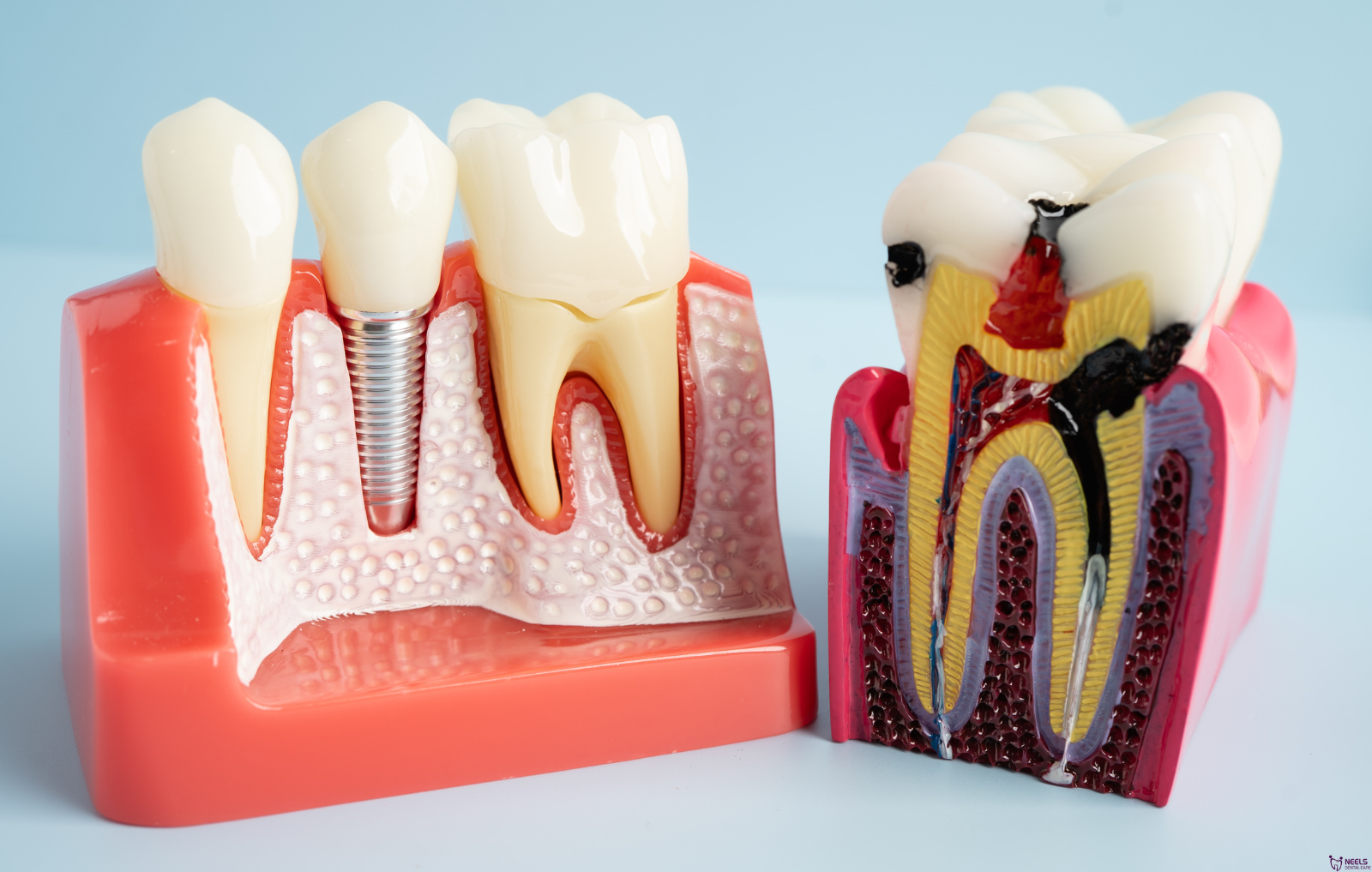 Dental Clinic in Madurai